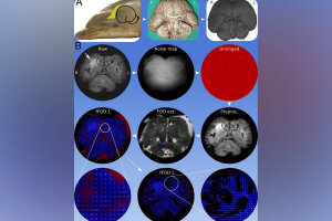 Constrained spherical deconvolution.jpg