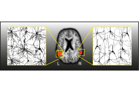 In vivo estimation of neurite density confirms microstructural asymmetries in gray matter