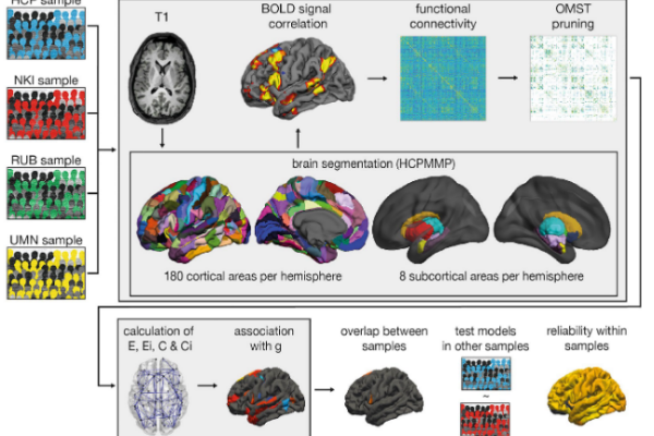 How is Intelligence Linked to the Brain.png