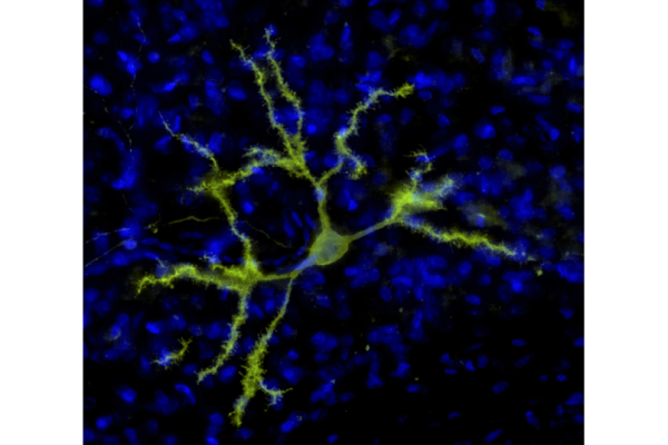 Neuron Detail