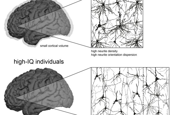 2018 Genc Smarter brains run on sparsely connected neurons 