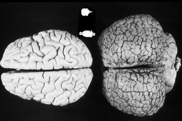 Where is the prefrontal cortex of the bottlenose dolphin