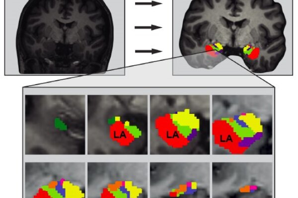 Cellular Correlates Of Neuroticism 2022