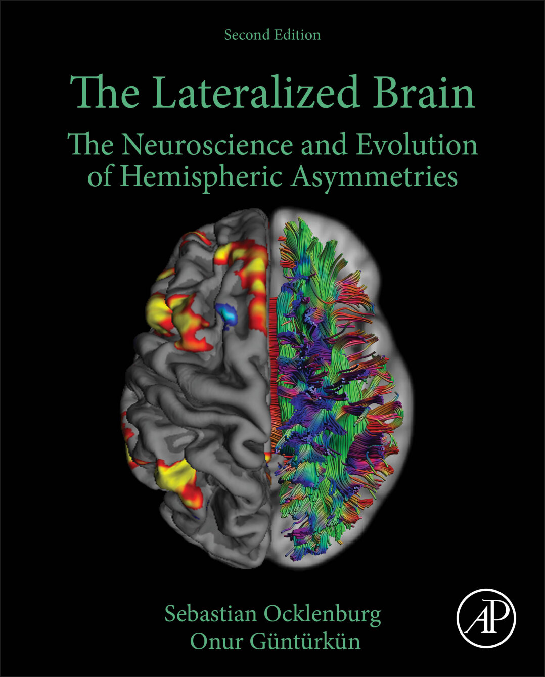 The Lateralized Brain