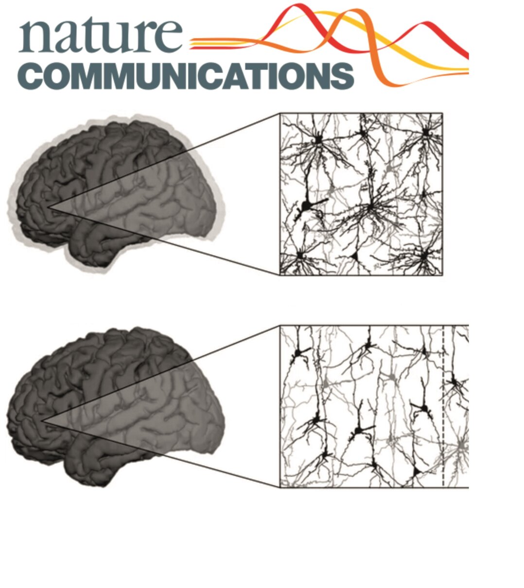 Cortical dendritic structure predicts IQ