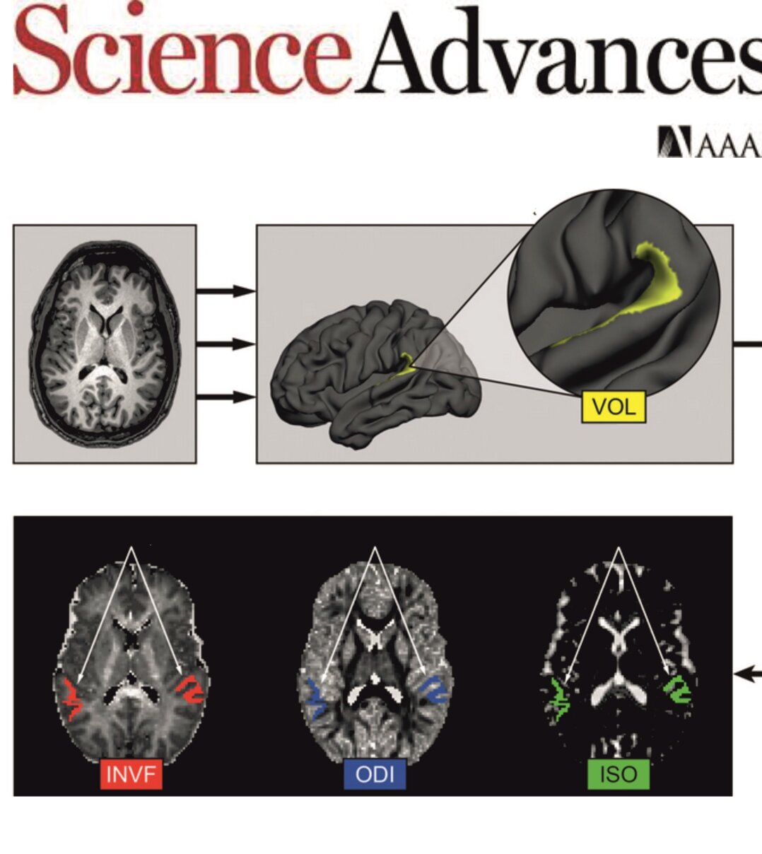 Neurite architecture predicts auditory speech processing